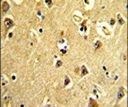 p21 ARC Antibody in Immunohistochemistry (IHC)