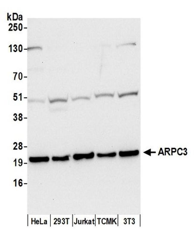 ARPC3 Antibody in Western Blot (WB)