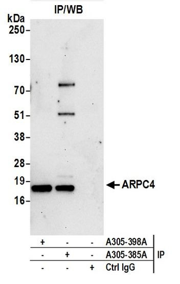 ARPC4 Antibody in Immunoprecipitation (IP)