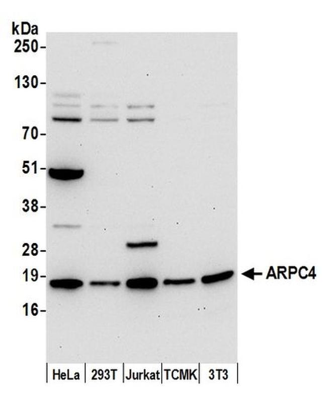 ARPC4 Antibody in Western Blot (WB)