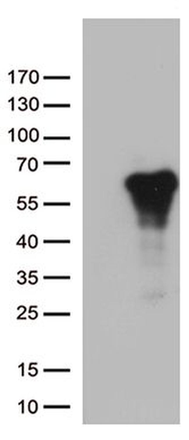 ARSG Antibody in Western Blot (WB)