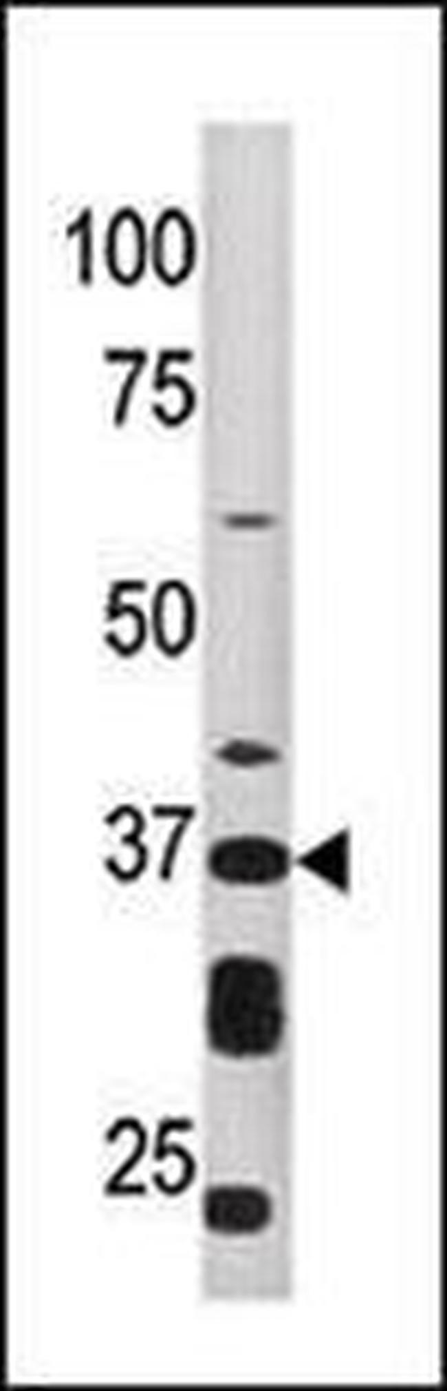 ART1 Antibody in Western Blot (WB)