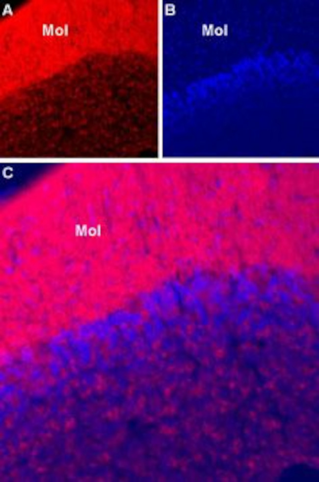 SCN1A (NaV1.1) Antibody in Immunohistochemistry (IHC)