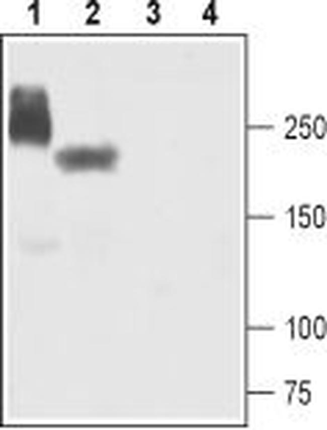 NaV1.5 (SCN5A) Antibody in Western Blot (WB)