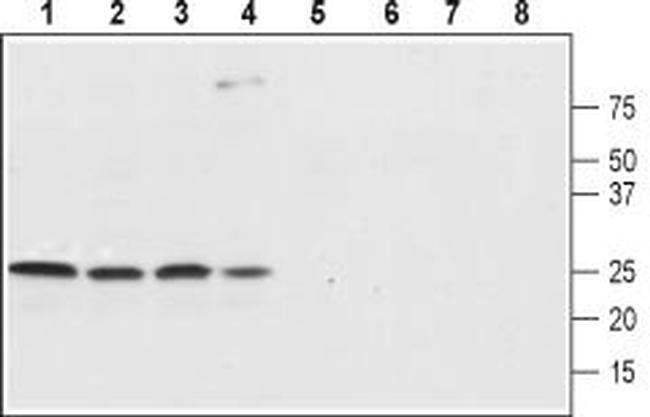 SCN4B (NaV beta 4) (extracellular) Antibody in Western Blot (WB)