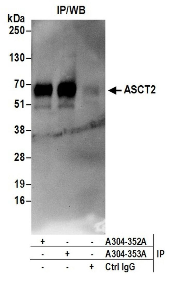 ASCT2 Antibody in Immunoprecipitation (IP)