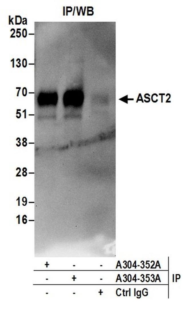 ASCT2 Antibody in Western Blot (WB)
