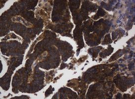 ASGR2 Antibody in Immunohistochemistry (Paraffin) (IHC (P))