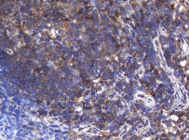 ASGR2 Antibody in Immunohistochemistry (Paraffin) (IHC (P))