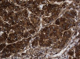 ASGR2 Antibody in Immunohistochemistry (Paraffin) (IHC (P))