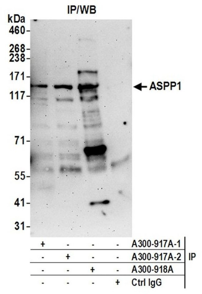 ASPP1 Antibody in Immunoprecipitation (IP)