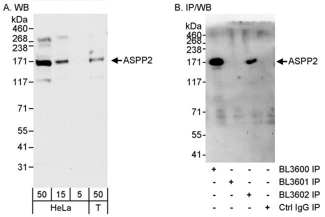 ASPP2 Antibody in Western Blot (WB)