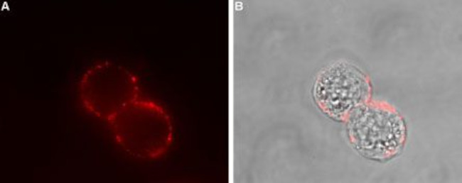 Somatostatin Receptor Type 2 (extracellular) Antibody in Immunocytochemistry (ICC/IF)