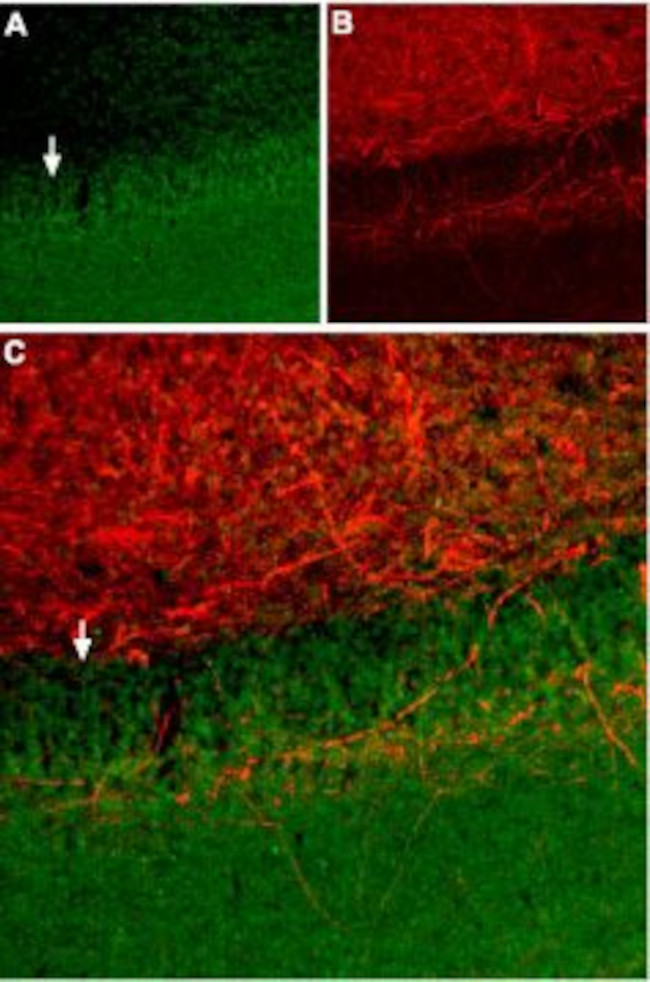 Somatostatin Receptor Type 2 (extracellular) Antibody in Immunohistochemistry (Frozen) (IHC (F))