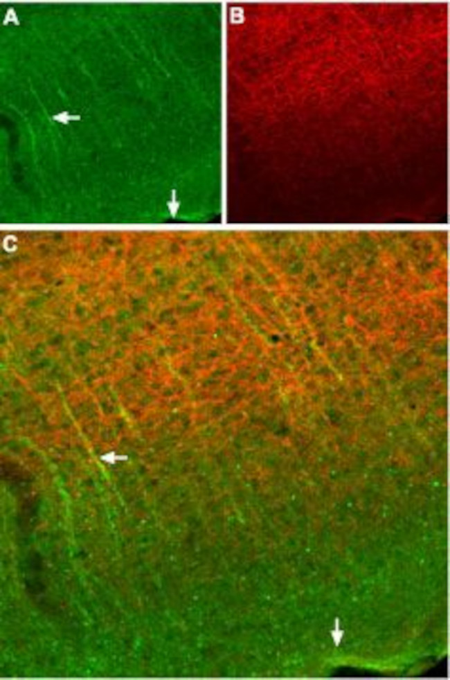 Somatostatin Receptor Type 2 (extracellular) Antibody in Immunohistochemistry (Frozen) (IHC (F))