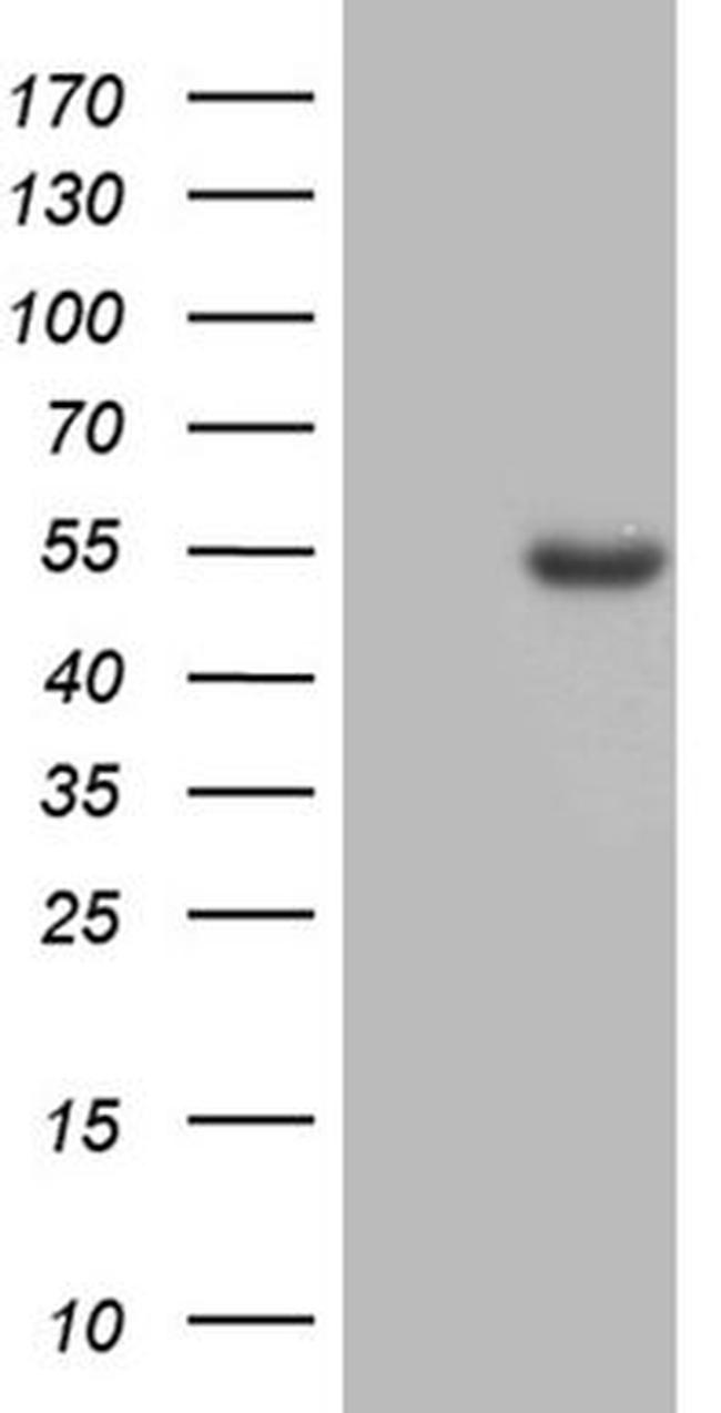 ASS1 Antibody in Western Blot (WB)