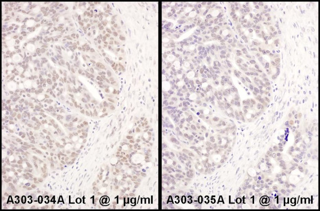 ATF1 Antibody in Immunohistochemistry (IHC)