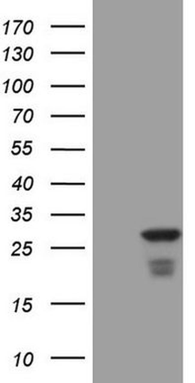 ATF3 Antibody in Western Blot (WB)