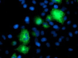 ATG3 Antibody in Immunocytochemistry (ICC/IF)