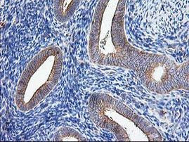 ATG3 Antibody in Immunohistochemistry (Paraffin) (IHC (P))