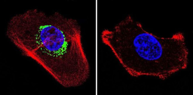 ATP Synthase beta Antibody in Immunocytochemistry (ICC/IF)