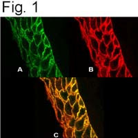 PMCA4 ATPase Antibody in Immunocytochemistry (ICC/IF)