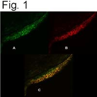 PMCA4 ATPase Antibody in Immunocytochemistry (ICC/IF)