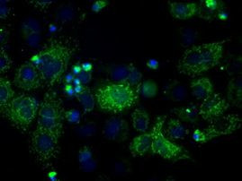 ATP5B Antibody in Immunocytochemistry (ICC/IF)