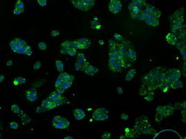 ATP5B Antibody in Immunocytochemistry (ICC/IF)