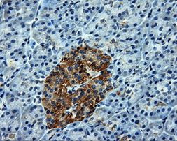 ATP5B Antibody in Immunohistochemistry (Paraffin) (IHC (P))