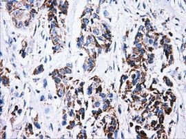 ATP5B Antibody in Immunohistochemistry (Paraffin) (IHC (P))