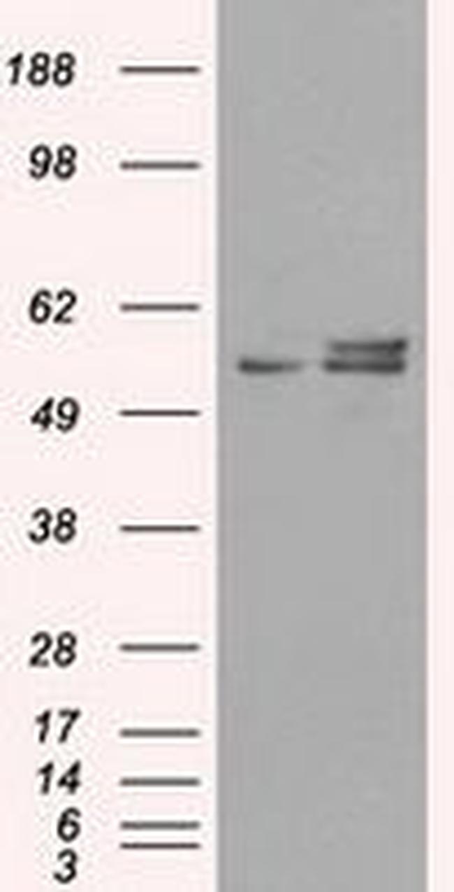 ATP5B Antibody in Western Blot (WB)