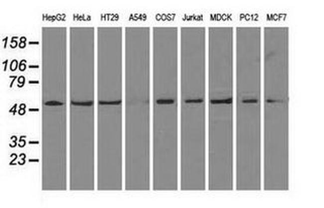 ATP5B Antibody in Western Blot (WB)