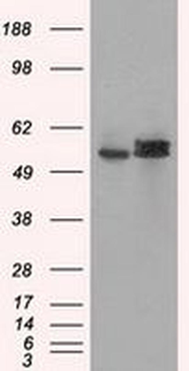 ATP5B Antibody in Western Blot (WB)