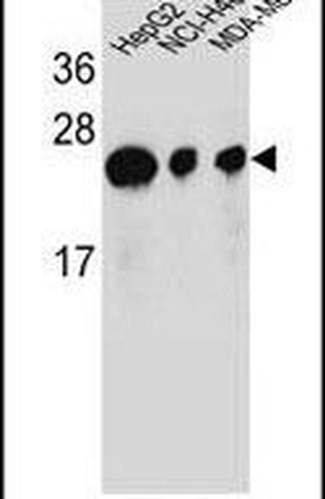 ATP5H Antibody in Western Blot (WB)