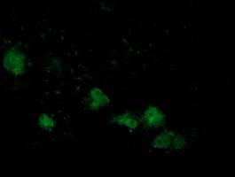 ATP6V1B1 Antibody in Immunocytochemistry (ICC/IF)