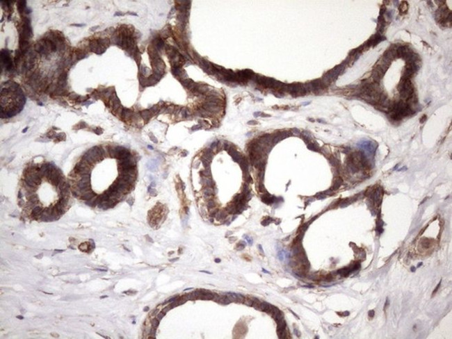 ATP6V1C2 Antibody in Immunohistochemistry (Paraffin) (IHC (P))