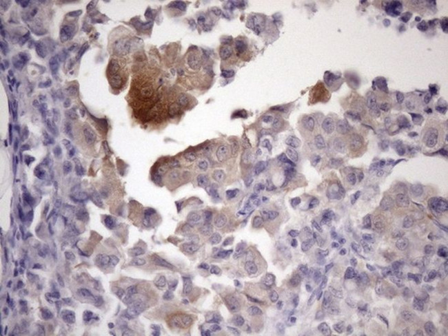 ATP6V1C2 Antibody in Immunohistochemistry (Paraffin) (IHC (P))