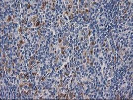 ATP6V1F Antibody in Immunohistochemistry (Paraffin) (IHC (P))