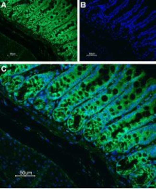 Neurokinin 1 Receptor (NK1R) (extracellular) Antibody in Immunohistochemistry (Paraffin) (IHC (P))