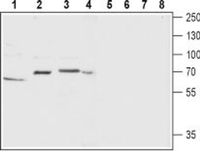 Neurokinin 1 Receptor (NK1R) (extracellular) Antibody in Western Blot (WB)