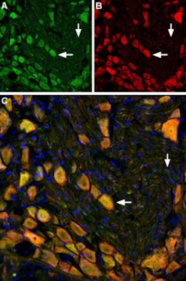 Neurokinin 1 Receptor (NK1R) (extracellular) Antibody in Immunohistochemistry (Paraffin) (IHC (P))