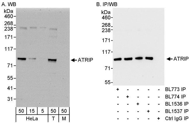 ATRIP Antibody in Western Blot (WB)
