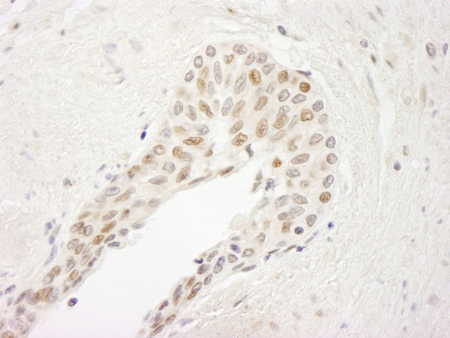 ATRIP Antibody in Immunohistochemistry (IHC)