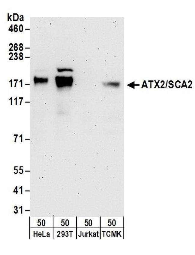ATX2/SCA2 Antibody in Western Blot (WB)