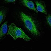 Aurora A Antibody in Immunocytochemistry (ICC/IF)