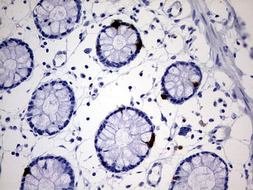 AVPI1 Antibody in Immunohistochemistry (Paraffin) (IHC (P))