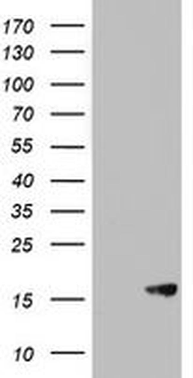 AVPI1 Antibody in Western Blot (WB)