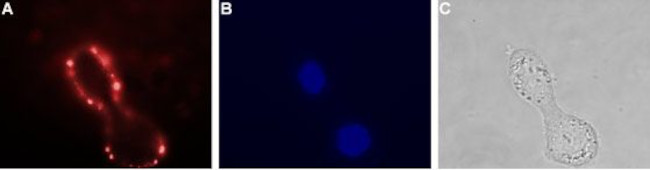 VPAC1 (VIPR1) (extracellular) Antibody in Immunocytochemistry (ICC/IF)