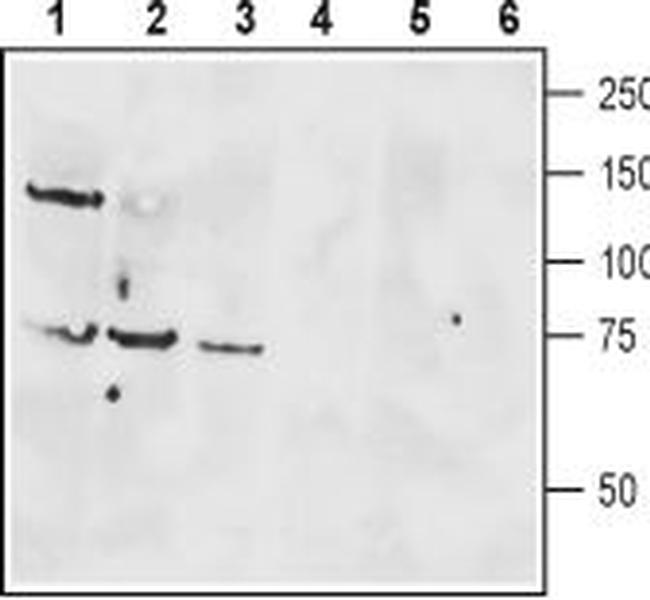 VPAC1 (VIPR1) (extracellular) Antibody in Western Blot (WB)